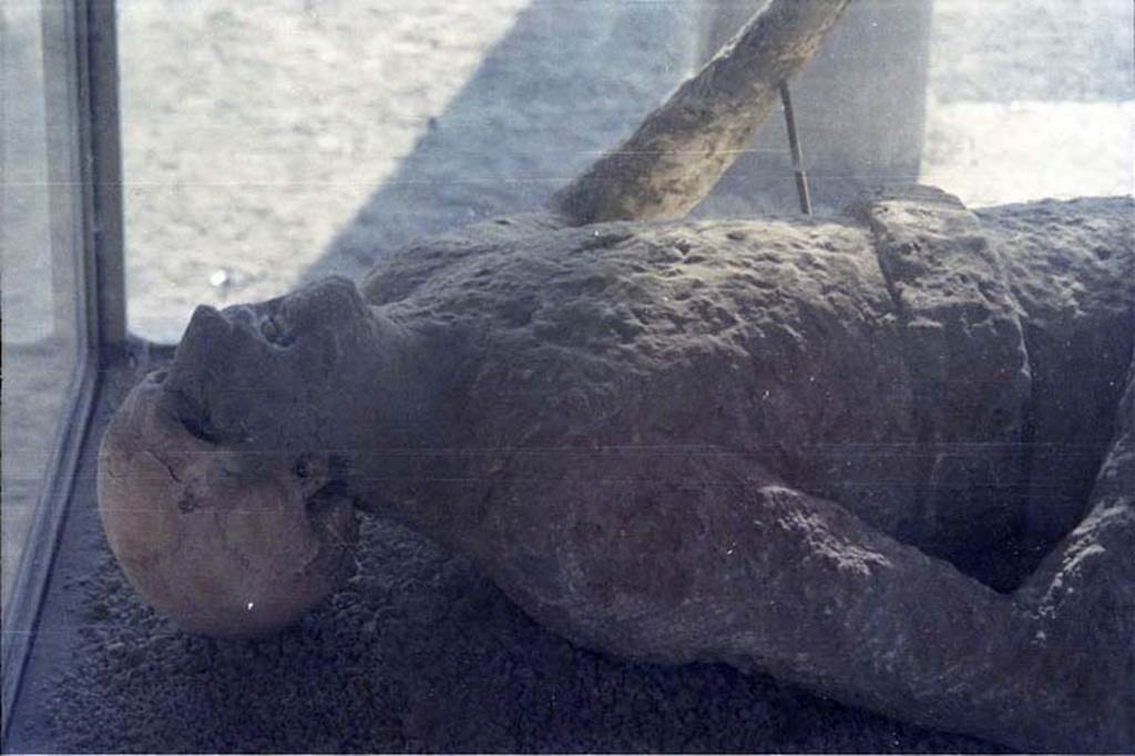 VII.9.7 and VII.9.8 Pompeii. July 2011. Detail of upper part of plaster cast of victim number 11 photographed in north-west corner of Macellum. 
Photo courtesy of Rick Bauer.
