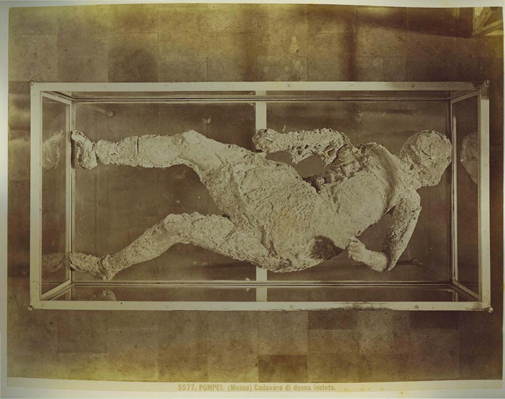 Victim number 4, photographed by Brogi, (no. 5577), described on the card as “The Pregnant Woman”, in a display case in the museum.
Photo courtesy of Eugene Dwyer.