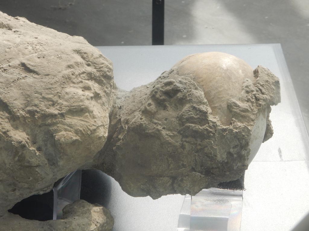 Victim 54. Plaster-cast of head of victim. May 2018. There is possibly the presence of a headdress. Photo courtesy of Buzz Ferebee.
See Osanna, N., Capurso, A., e Masseroli, S. M., 2021. I Calchi di Pompei da Giuseppe Fiorelli ad oggi: Studi e Ricerche del PAP 46, p. 446, Calco n. 54.
